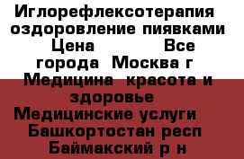 Иглорефлексотерапия, оздоровление пиявками › Цена ­ 3 000 - Все города, Москва г. Медицина, красота и здоровье » Медицинские услуги   . Башкортостан респ.,Баймакский р-н